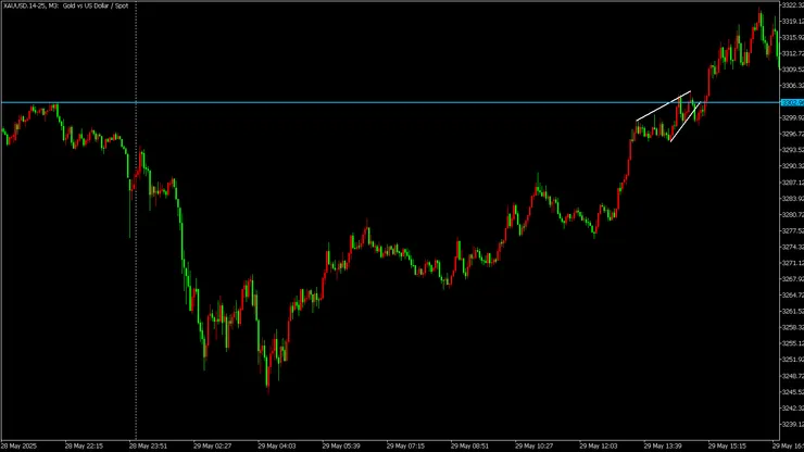 楔形過高 M3時區