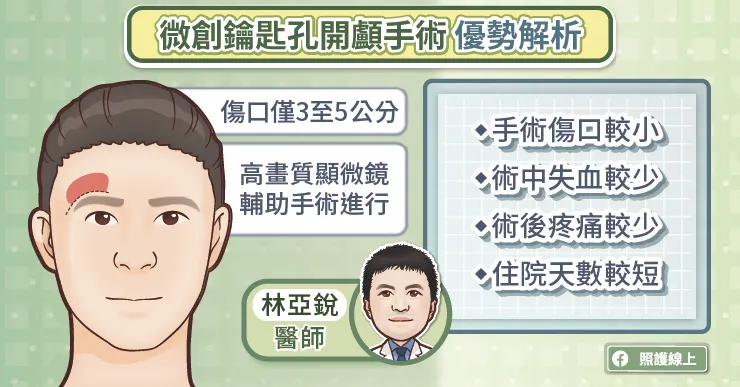 微創鑰匙孔開顱手術優勢解析
