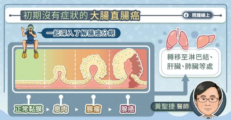 大腸直腸癌初期症狀不明顯