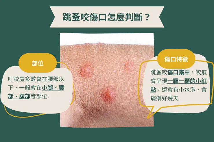 被跳蚤咬的特徵