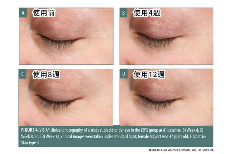 眼周保養成分怎麼選？