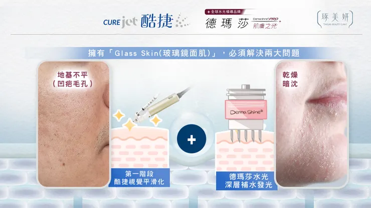 逆轉肌齡的「逆時針」美學!酷捷+水光雙強聯手,毛孔凹疤消失、肌膚透出玻璃光!