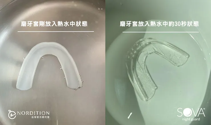 SOVA® 3D防磨牙牙套▁  泡熱水