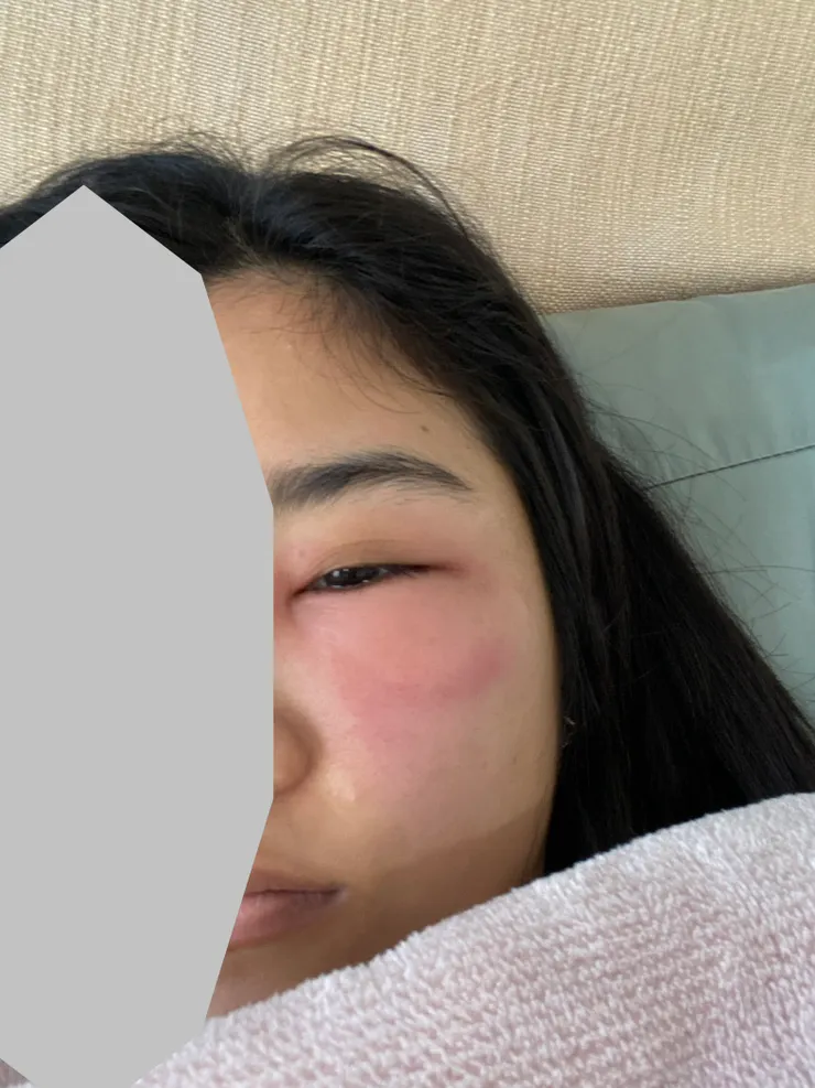 他直接叮我臉（我哭啊