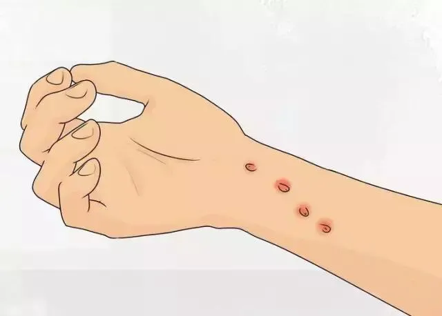 多觀察貓咪咬傷的傷口,是否有出現紅腫 癢痛等...情形發生