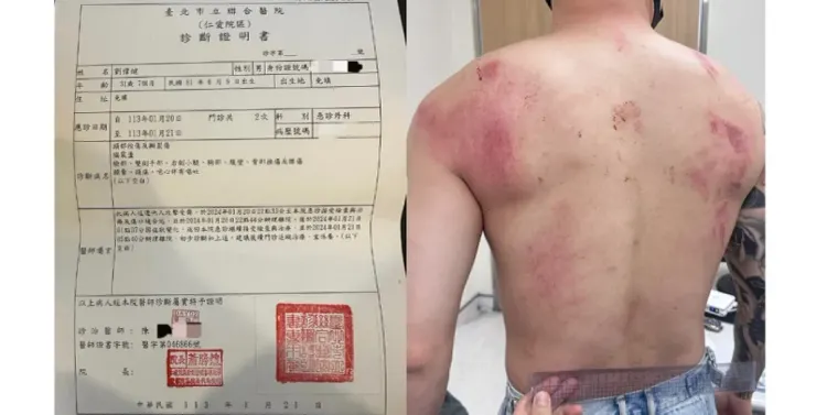Toyz傷勢診斷證明 / 取自：IG@ toyzlol