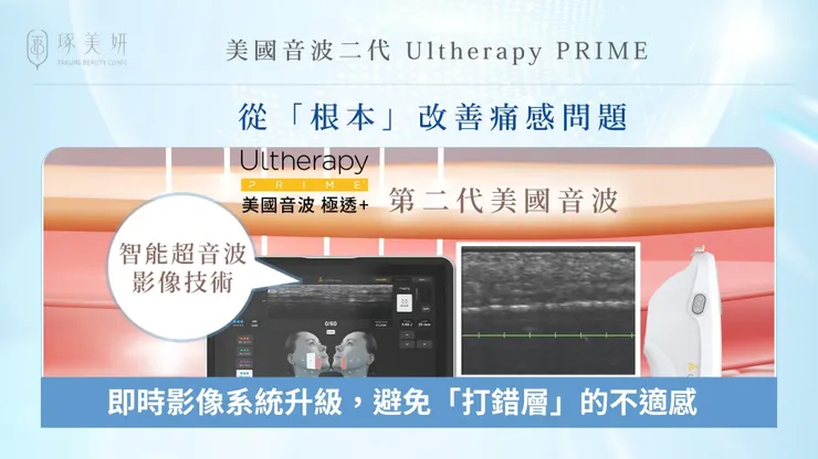怕痛又想拉提?美國音波二代 Ultherapy PRIME為什麼被稱為「溫柔版音波」?