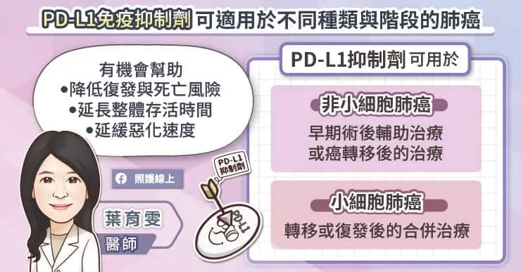 PD-L1免疫抑制劑可適用於不同種類與階段的肺癌