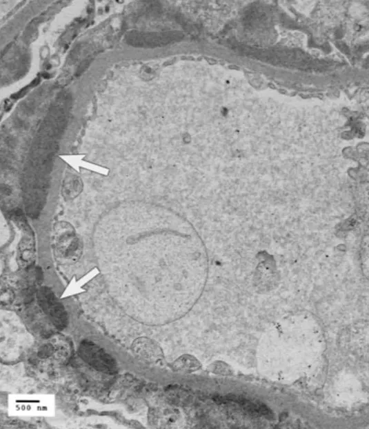 穿透式電子顯微鏡