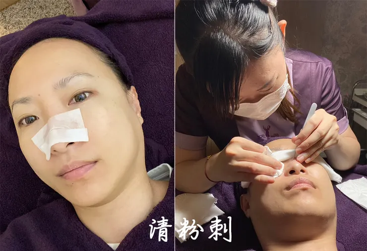 板橋美容去角質保養推薦│芮薇荷夢幻森林spa-板橋館│水飛梭氫水儀