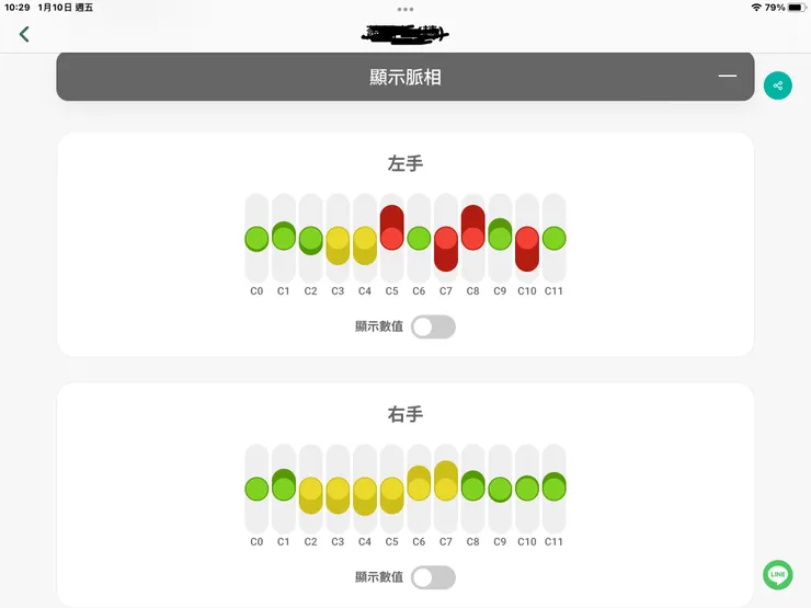 圖一：侯奶奶調理前脈診72歲的脈像