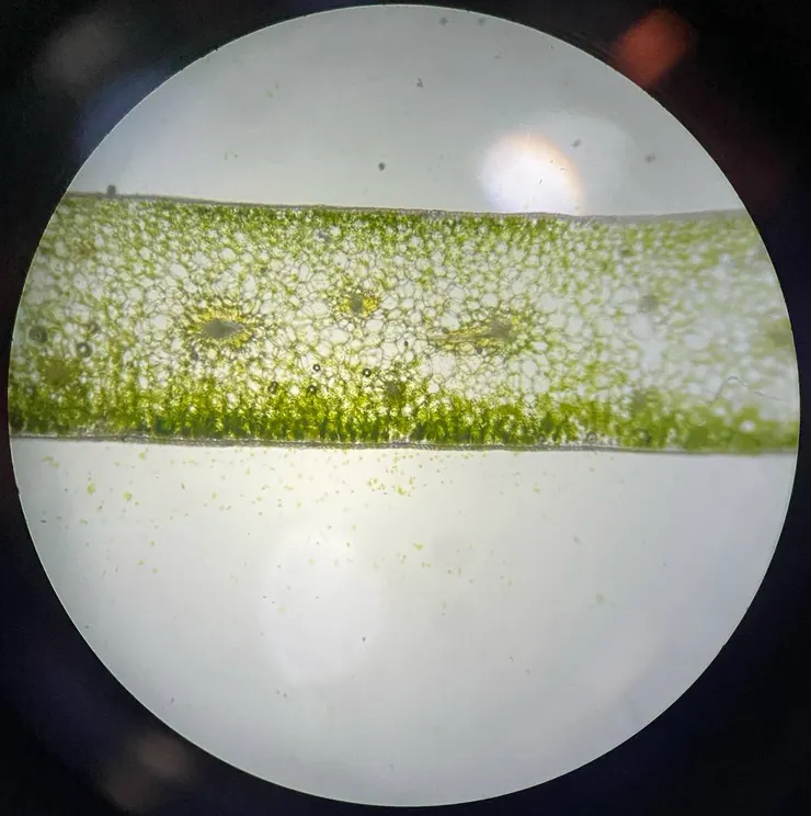 Cross Section of leaf of Dracaena trifasciata (40x)