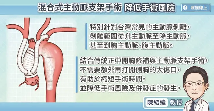 混合式主動脈支架手術 降低手術風險