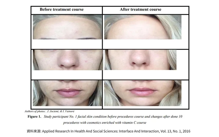 早C晚A 誰重要？兩大時機深入挑戰「早C好處」的保養計畫