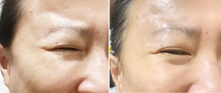 美容儀推薦│ZIIP HALO 好萊塢名人加持「掌上型」奈米微電流智能美膚管家