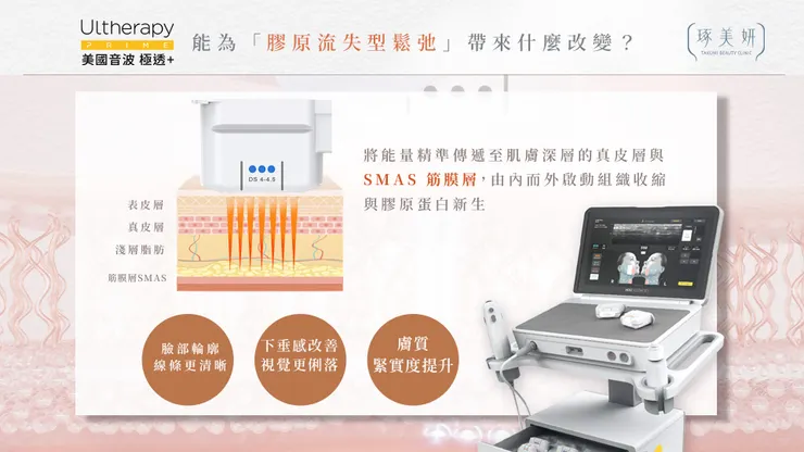 臉鬆不是老,是膠原蛋白在流失!美國音波二代 Ultherapy PRIME 能幫你做什麼?