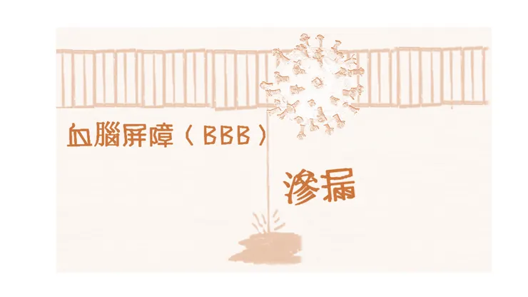 揭開長新冠腦霧之迷霧 IV: 血腦屏障(BBB)壞了