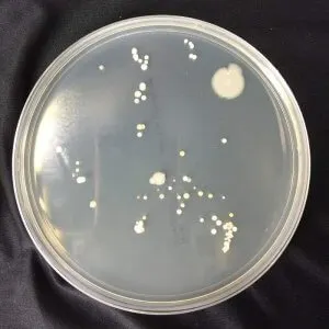 菌落，指的是細菌聚集起來所形成的聚落。雖然肉眼看起來只是一個小白點，但有可能就包含著成千上萬顆細菌。(Photo from 台美檢驗)