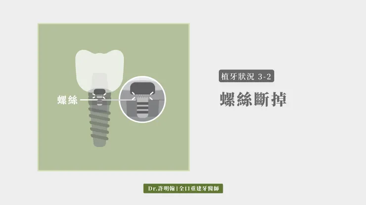 第3-2種植牙狀況：螺絲斷掉
