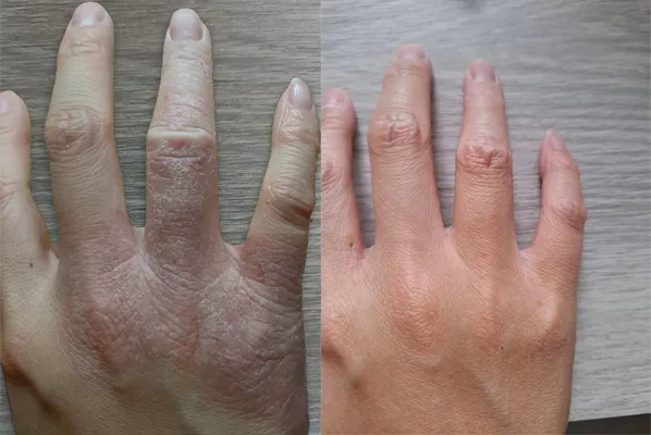 沒圖沒真相(手是真的背景是假的)