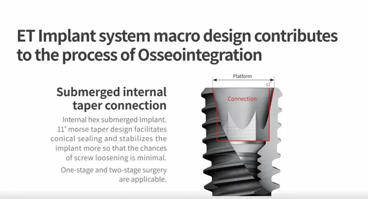為何選擇「平價植牙」也能安心?解析Hiossen植牙受歡迎原因!