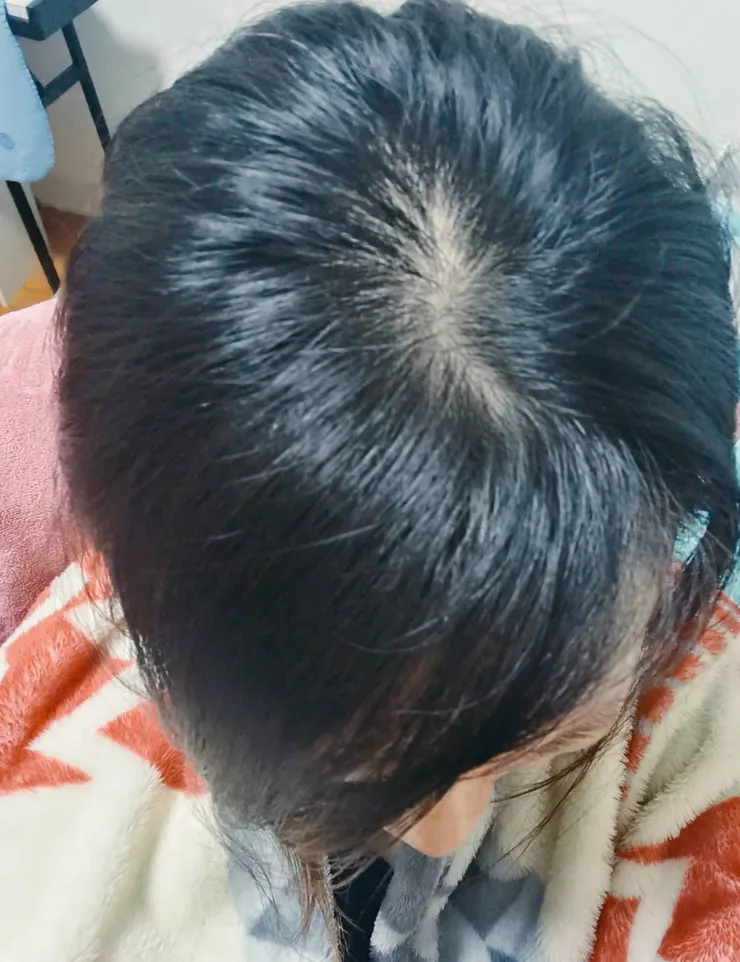 開始保養後，沒有那麼乾燥+灰灰白白了!!