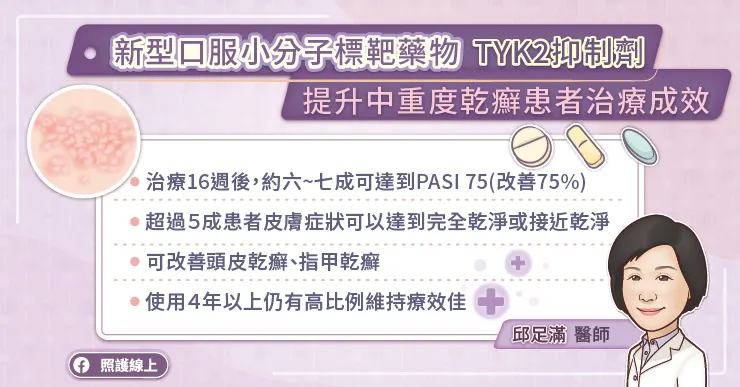新型口服標靶藥物（TYK2抑制劑）提升中重度乾癬治療成效