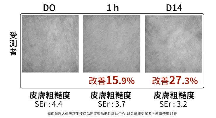 悶痘長不停怎麼辦?