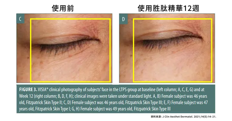 眼周保養成分怎麼選？