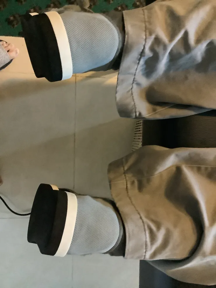 圖二：謝大哥腳踝長期調理後的對稱