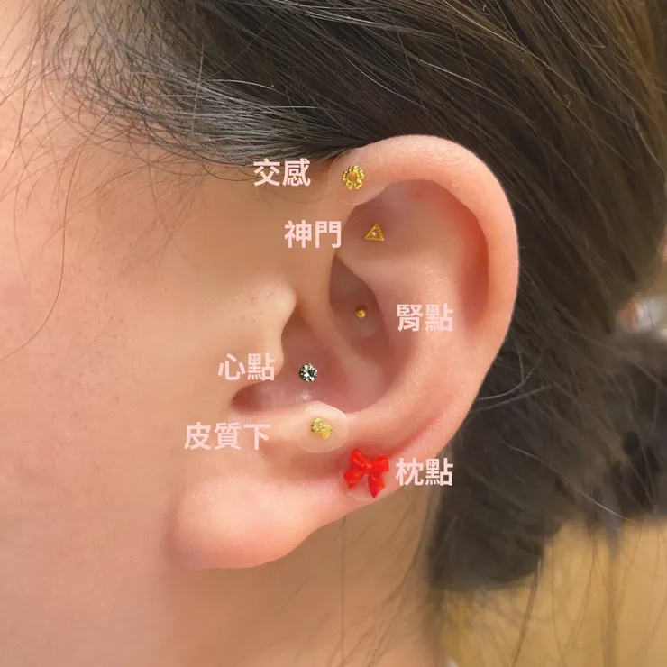 耳穴貼穴道-幫助睡眠