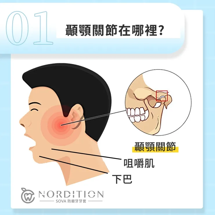 SOVA®️防磨牙牙套小教室 ◤ 顳顎關節在哪裡 ◢