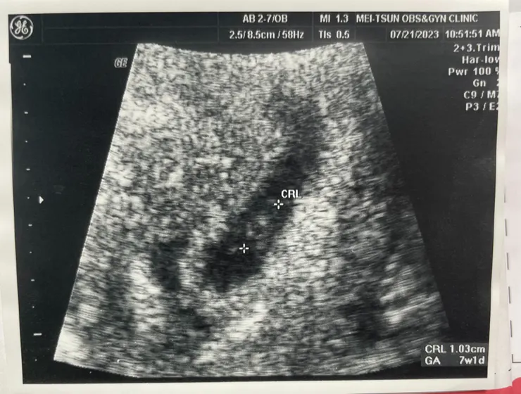 第一張小福氣照片!! 小小的只有1.03cm