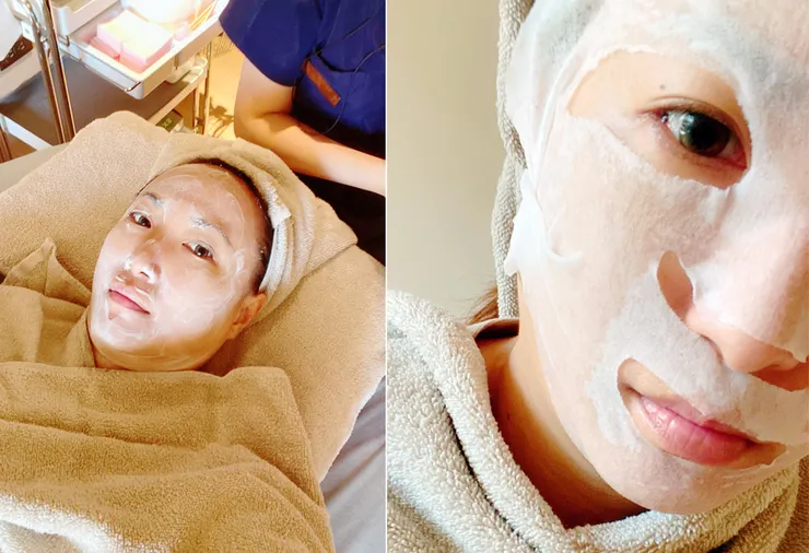 台北東區打雷射｜RedTouch PRO凍態雷射(果凍光)│台北打雷射推薦綻妍醫美診所