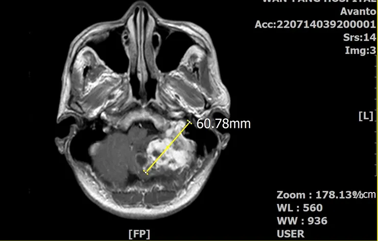 椰當年在MRI下的龐大身軀(水平剖面)