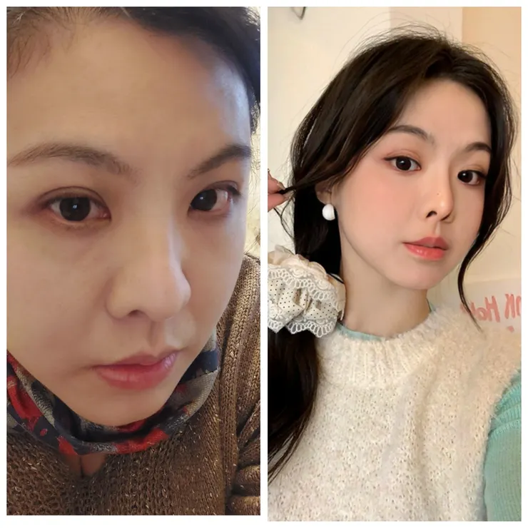 就跟頭像比，我自己覺得沒差非常多啦！