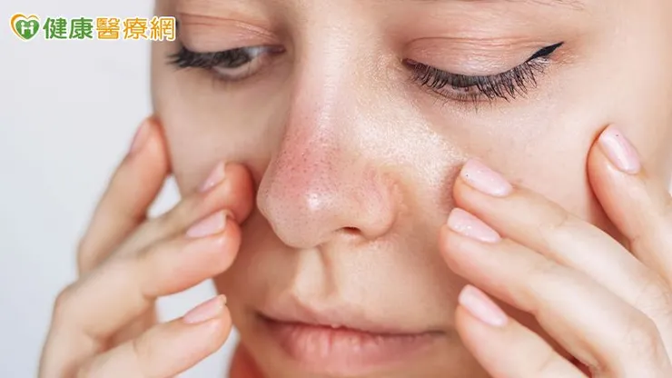 蒼藍鴿（吳其穎醫師）表示，毛孔粗大主因包括油脂過多、膠原蛋白流失與不當清潔。