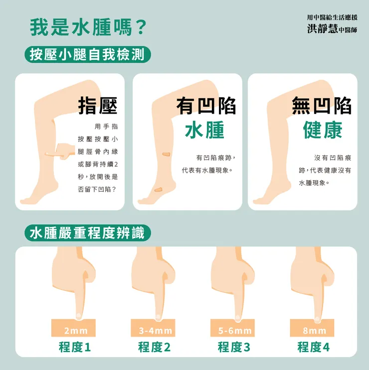 按壓小腿水腫自我檢測