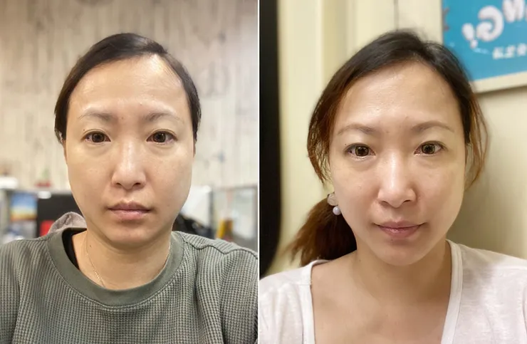 美容儀推薦│ZIIP HALO 好萊塢名人加持「掌上型」奈米微電流智能美膚管家