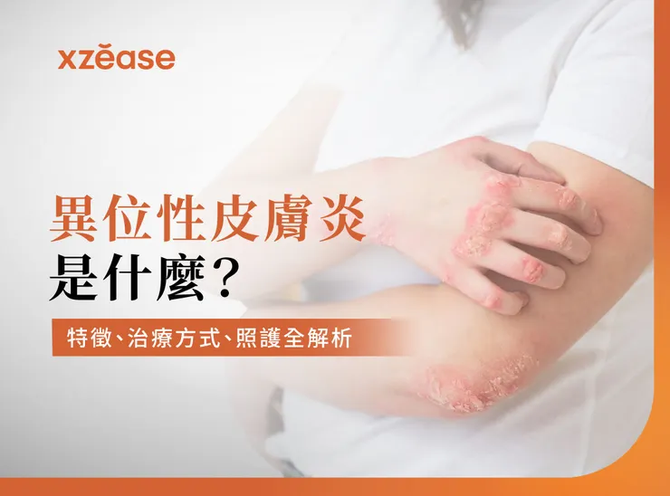 異位性皮膚炎是什麼