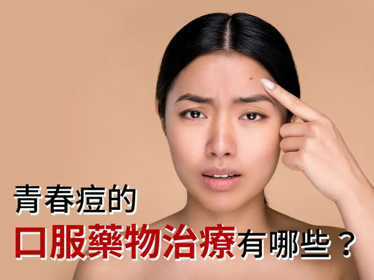 長痘痘為什麼要吃抗生素？