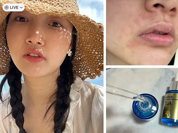 脂漏性皮膚炎保養推薦-肌密青春原液