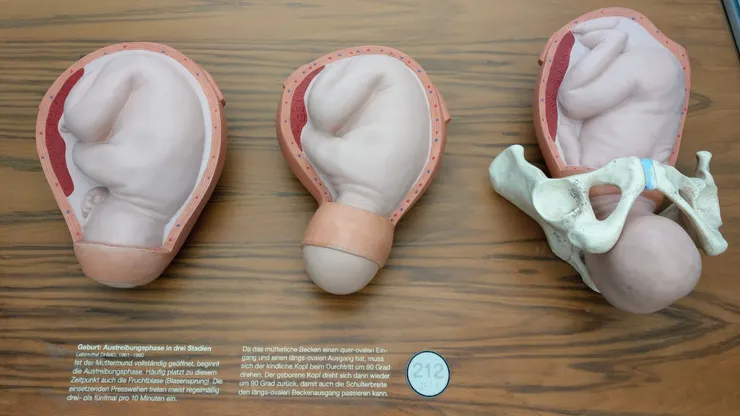 因為陰道是橢圓形的,寶寶的肩膀要順著長軸生產