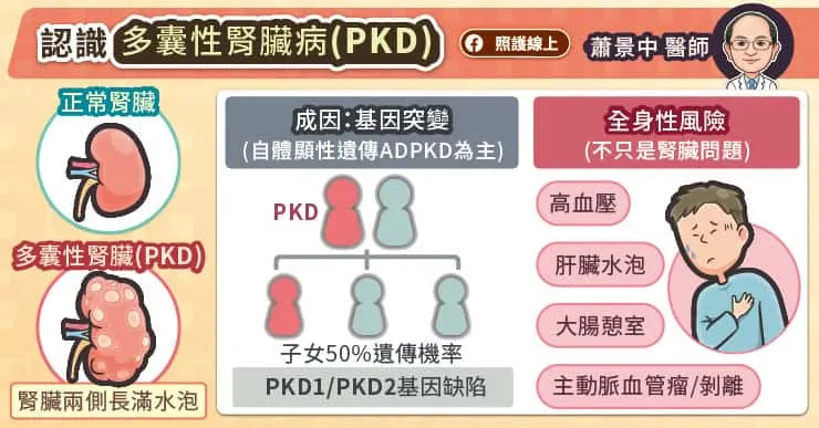 認識多囊性腎臟病