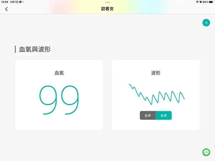 圖一：吳媽調理前右心波圖