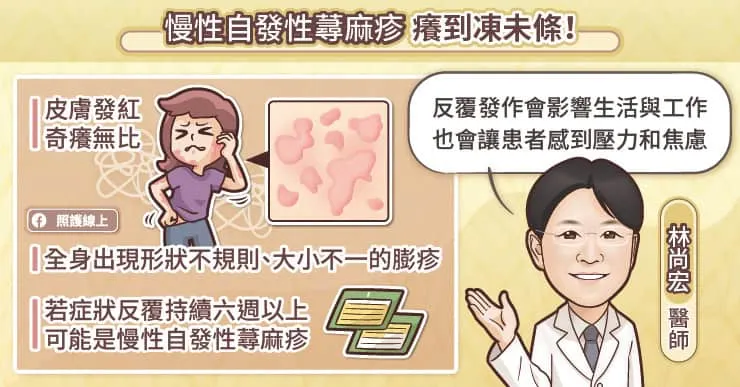 慢性自發性蕁麻疹癢到凍未條