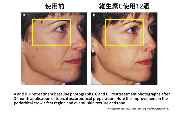 眼周保養成分怎麼選？