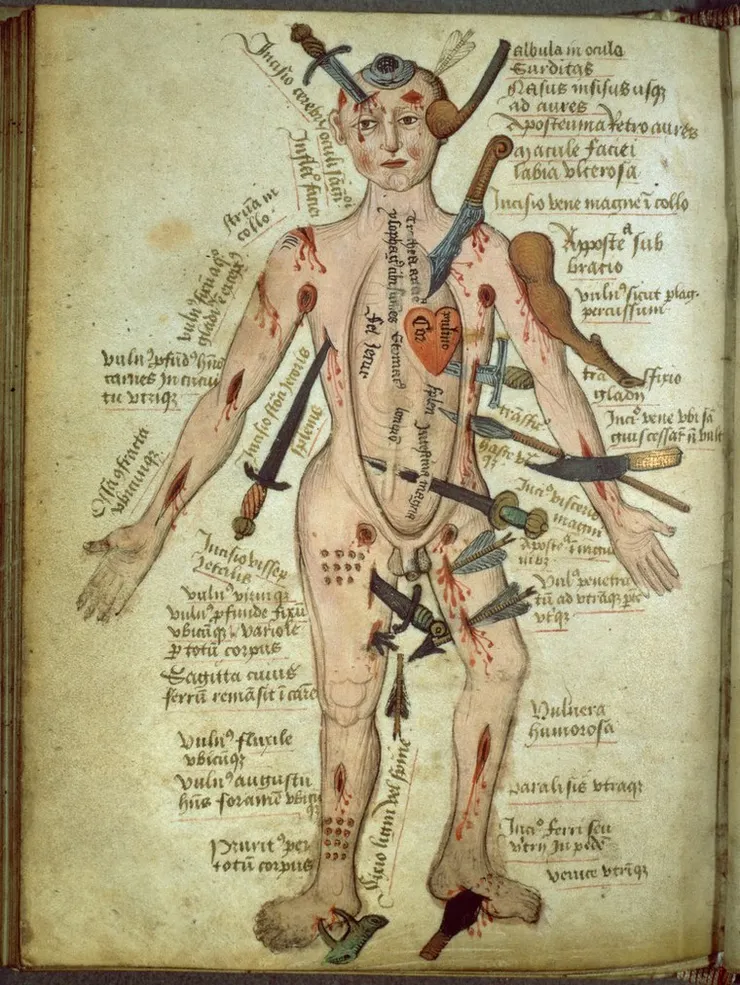 傷口人（Wound man, Pseudo-Galen, Anathomia）。圖片來源：Wellcome Collection