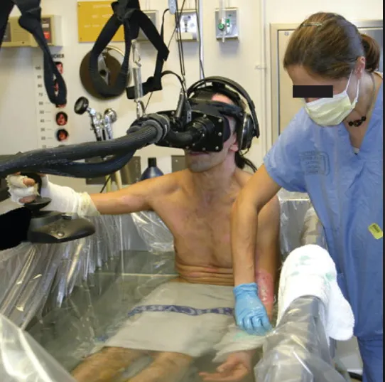 虛擬「雪世界」幫助燒傷患者應對極度疼痛