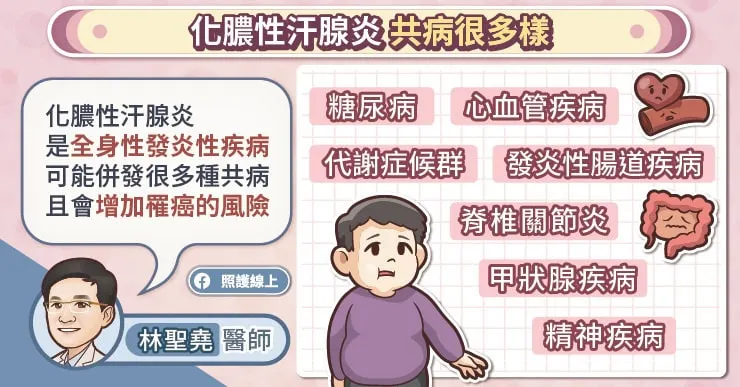 化膿性汗腺炎共病很多樣